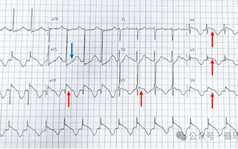揭开“圆顶尖盔征”的神秘面纱
