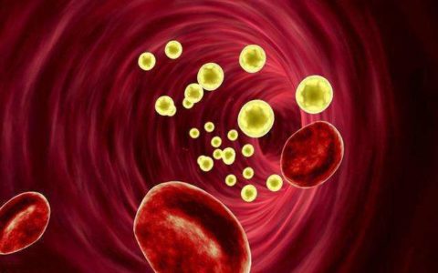 《中国血脂管理指南(2023)》更新要点