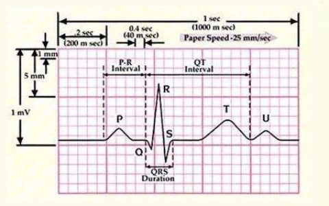 房颤的药物复律治疗